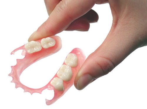 ノンクラスプデンチャー