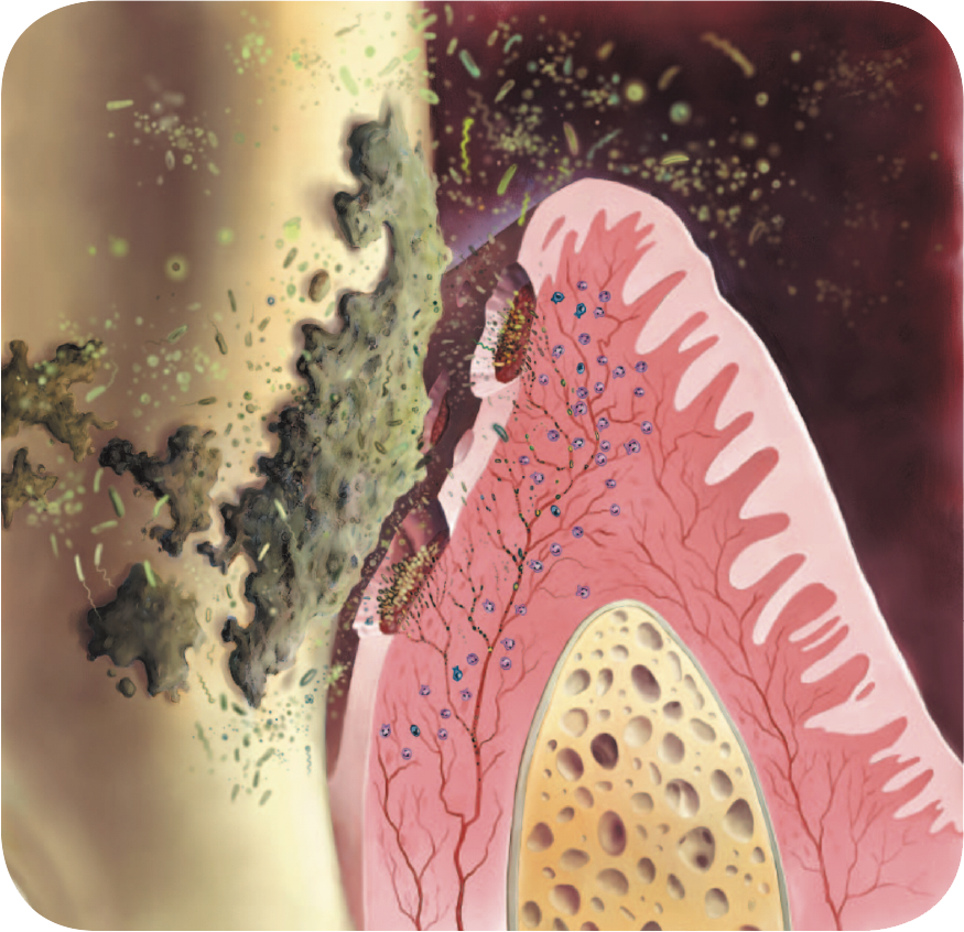 バイオフィルム